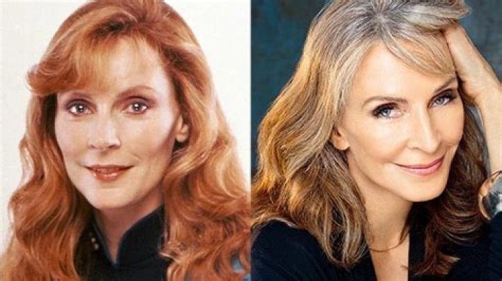 Did Gates Mcfadden Have Plastic Surgery?