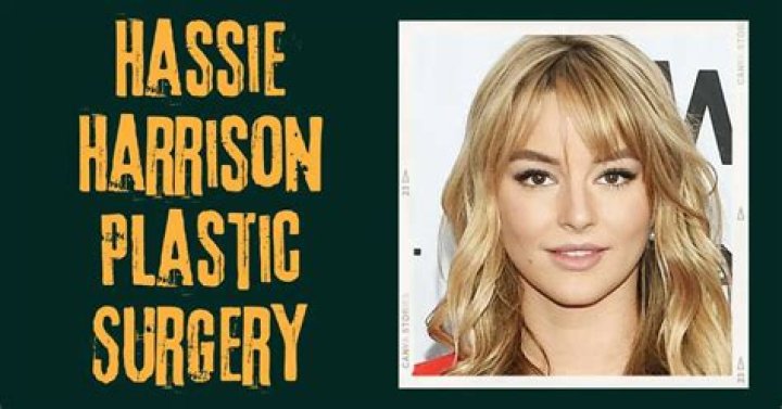 Hassie Harrison Plastic Surgery: Has She Gone Under The Knife?