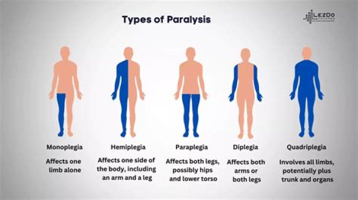 Is Mark Shields in a wheelchair? Wound that partially paralyzed him explained |