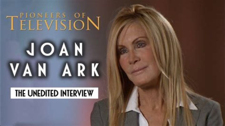 Plastic Surgery Journey Of Joan Van Ark: Unveiling New Perspectives