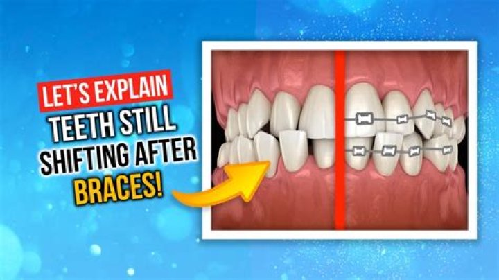 Why do teeth feel slimy after braces?